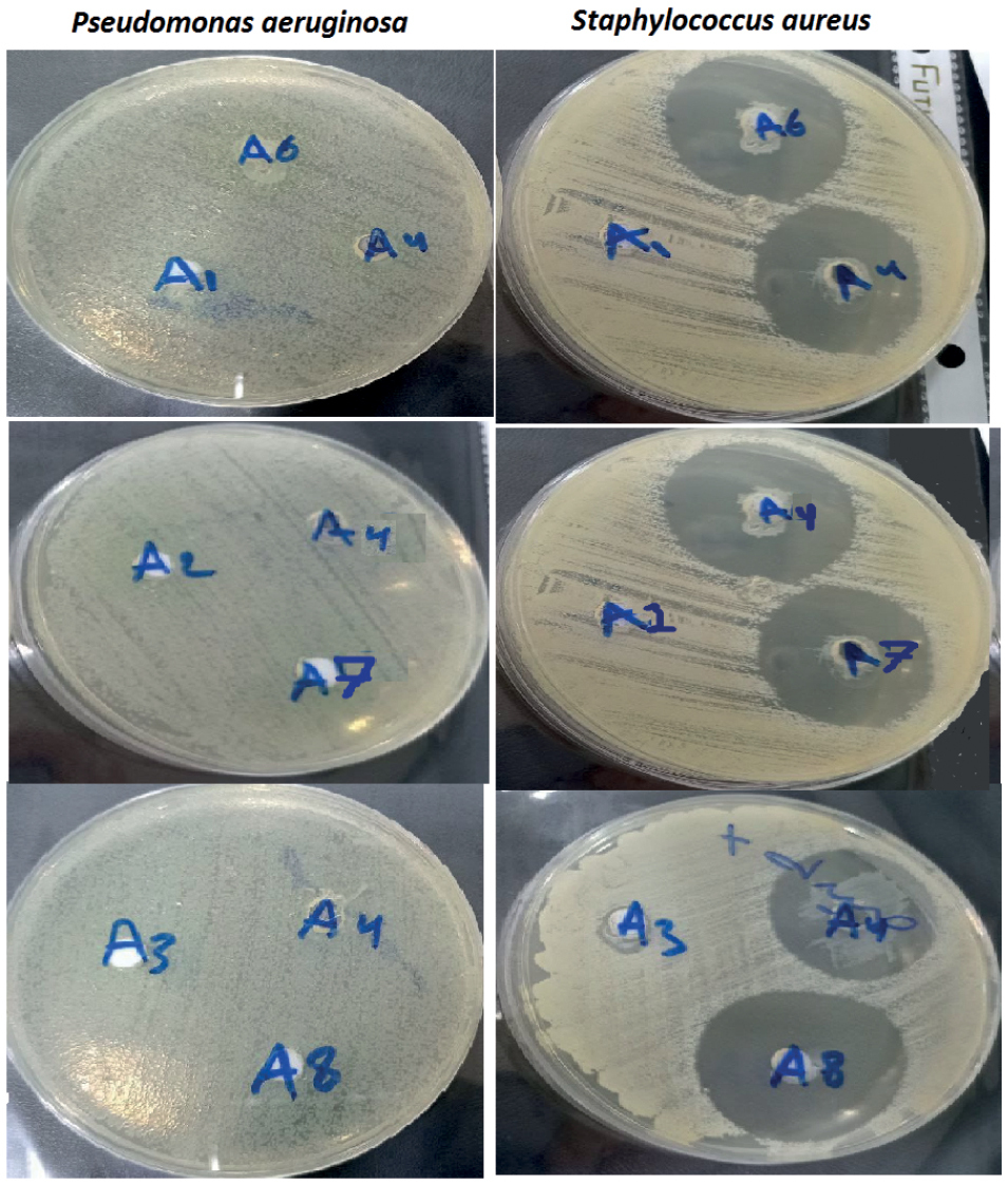 Clindamycin And Metronidazole industry insight