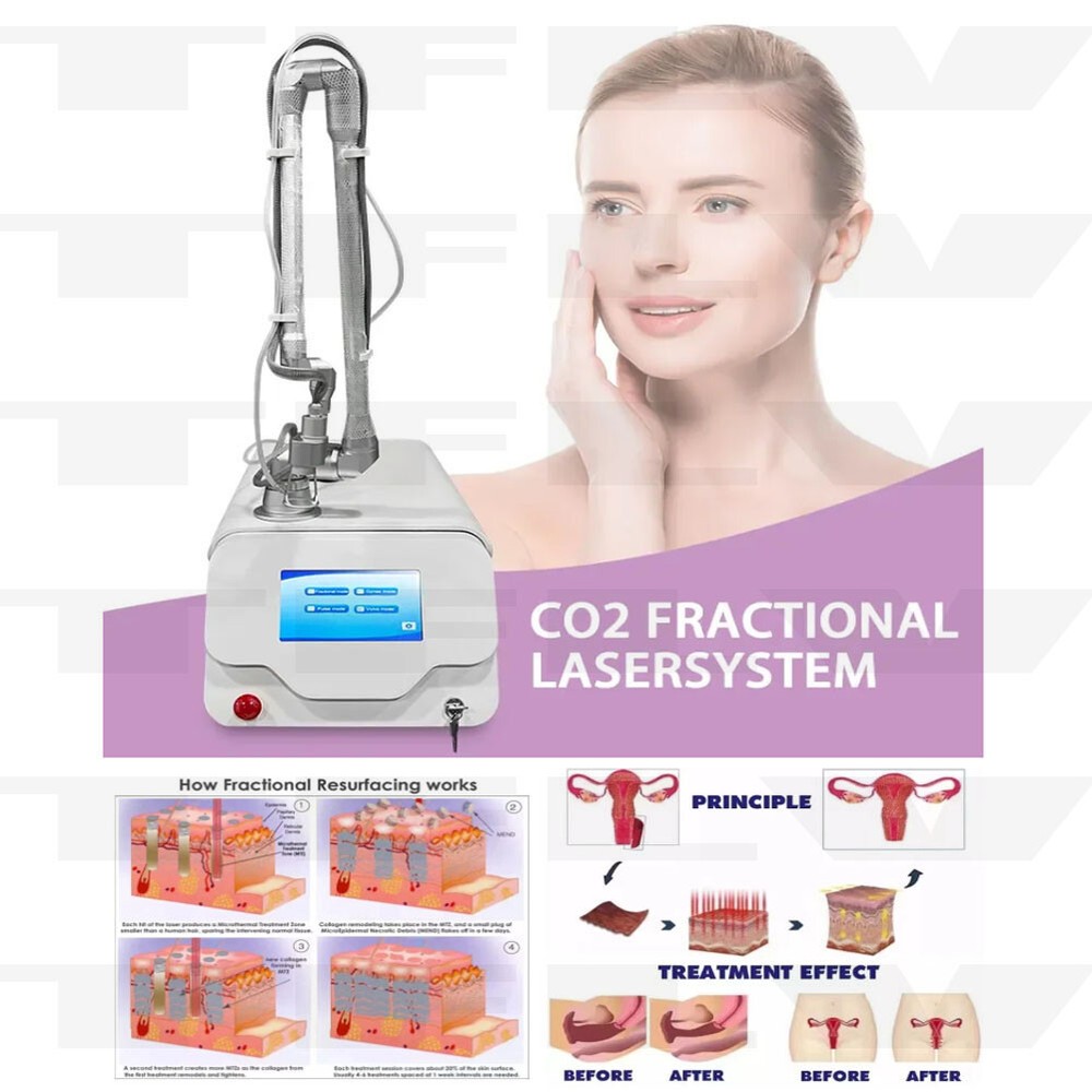 Fractional CO2 Laser Machine