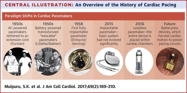 Pacemaker Companies industry insight