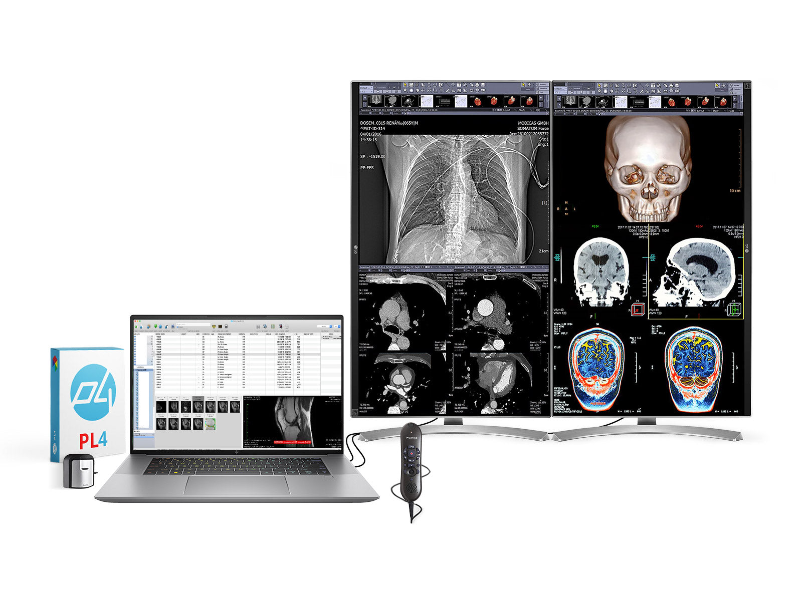 Radiology Computer Monitor industry insight