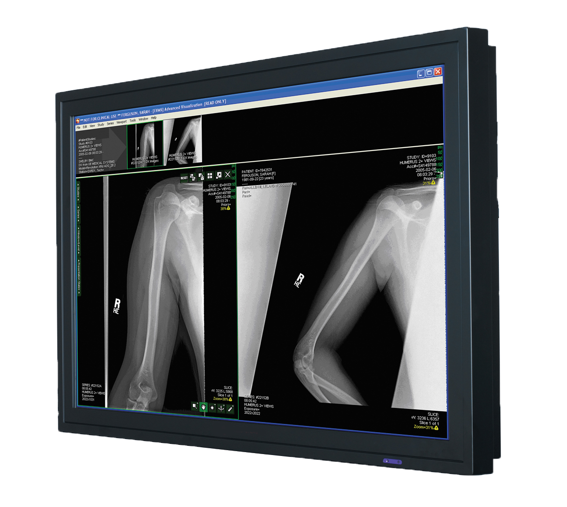 Radiology Monitor
