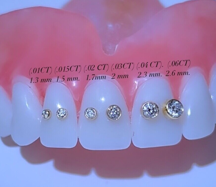 Tooth Gems & Dental Jewelry