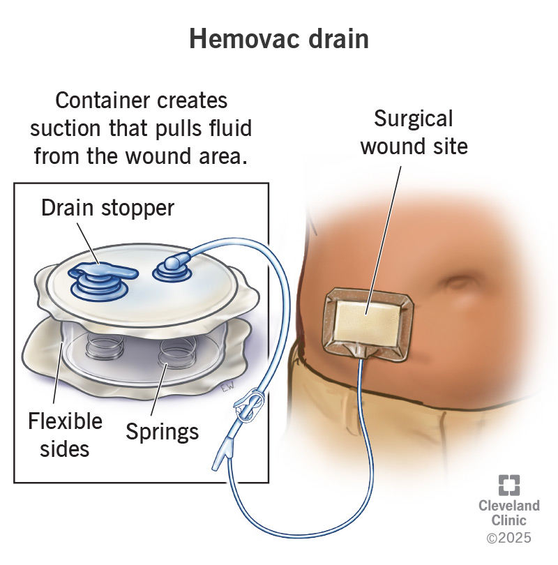Wound Drainage & Drains